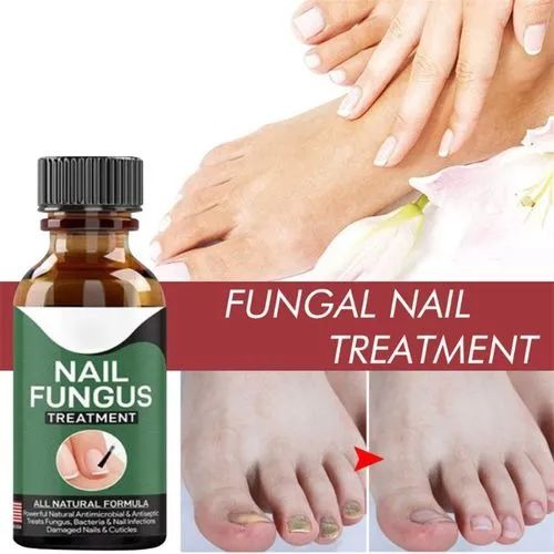 Fast Nail Fungus Treatment Serum – Nail Repair