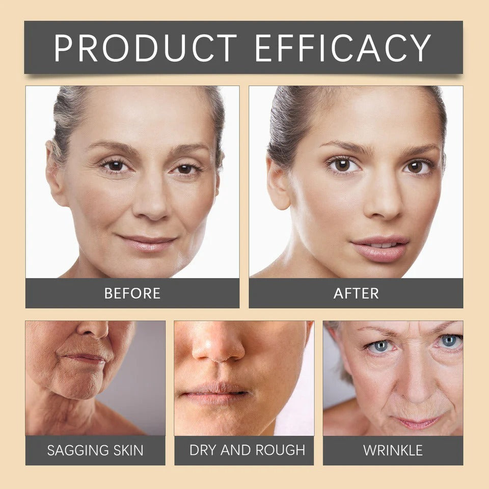 Botox Bee Venom Whitening & Moisturizing Cream – Anti-Aging